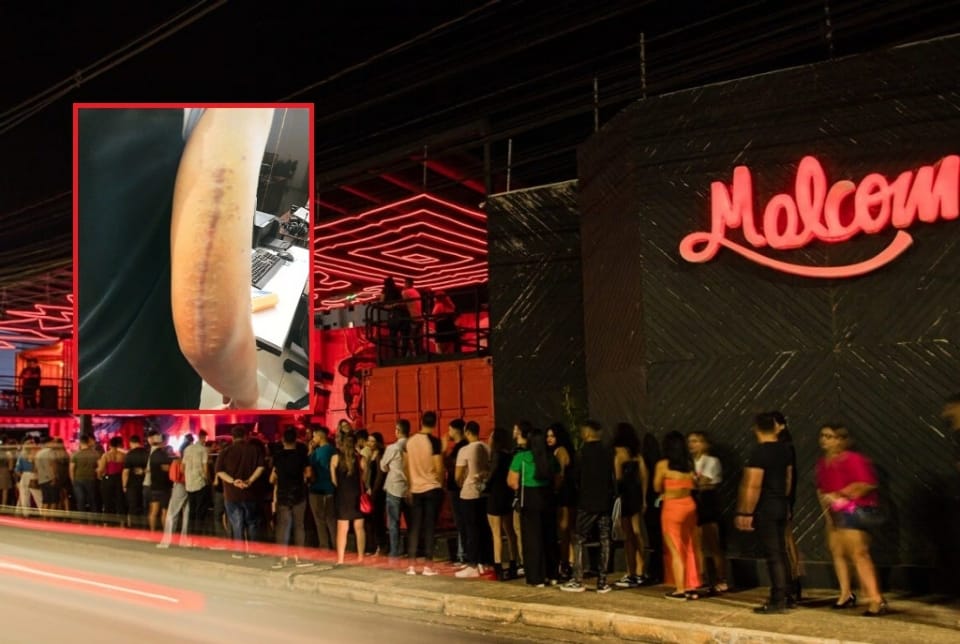 Juiz condena Malcom Pub a pagar R$ 40 mil de indenização a cliente agredido por seguranças