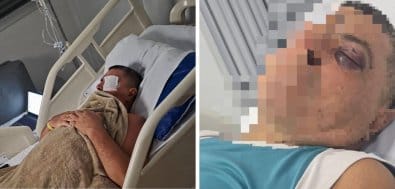 Vereadores denunciam agressão de policiais penais contra idoso em avenida de Cuiabá