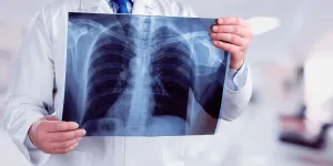 Justiça garante adicional de insalubridade para técnico em radiologia sem precisar de perícia